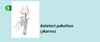 Paketin Açılması