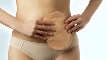 Stoma Bakımı